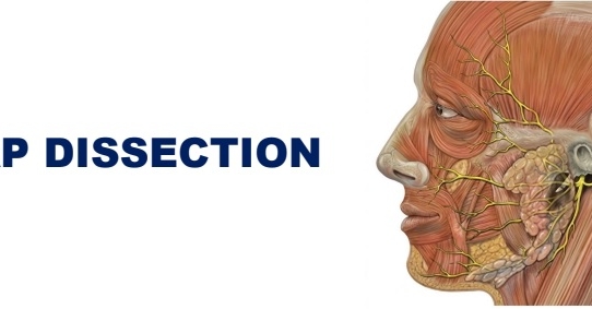 FLAP DISSECTION