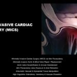 MINIMALLY INVASIVE CARDIAC SURGERY (MICS)
