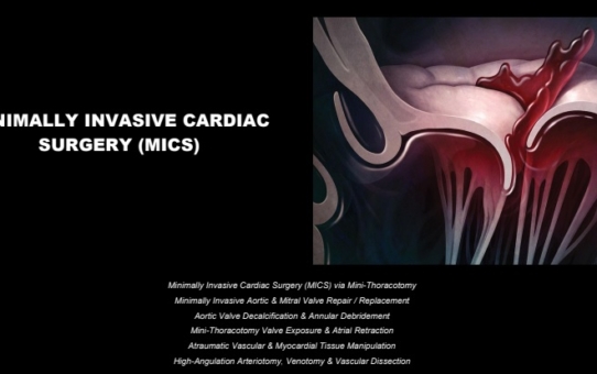 MINIMALLY INVASIVE CARDIAC  SURGERY (MICS)