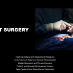 OPEN-HEART SURGERY
