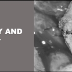 VASOVASOSTOMY AND VASECTOMY